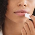 Effective Strategies for Treating and Preventing Dry, Cracked Lips
