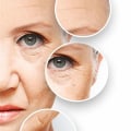 Effective Strategies to Prevent and Treat Wrinkles and Fine Lines