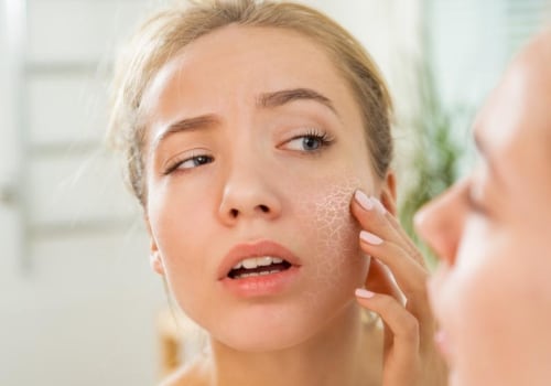 Effective Strategies for Treating Dry, Flaky Skin on Your Face