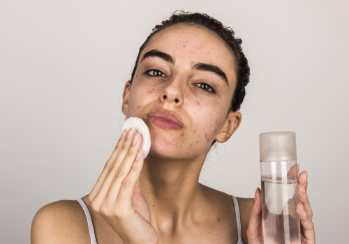 Effective Skincare Strategies to Prevent Breakouts and Acne