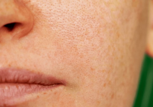 Effective Skincare Tips to Minimize the Appearance of Pores