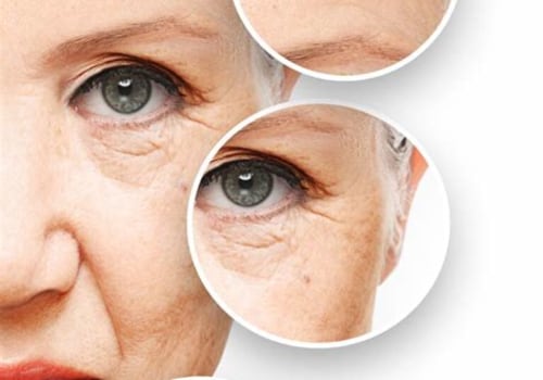 Effective Strategies to Prevent and Treat Wrinkles and Fine Lines